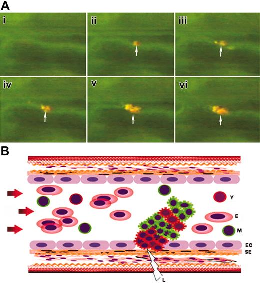 Figure 7. Kinetics of thrombocyte recruitment of growing thrombus. (A) Time-lapse images captured from the real-time video of thrombus formation in zebrafish. Arrows mark the initiation of thrombus. Orange and greenish-yellow colors in the thrombus represent the dual dye-labeled and single dye-labeled thrombocytes/platelets respectively. (B) Schematic representation of growing thrombus (corresponding to time-lapse images shown in panel A) in an artery with initiating young thrombocyte (Y) clusters at the site of laser injury (L) followed by mixture of Y and mature thrombocyte (M) clusters. EC indicates endothelial cell; SE, subendothelial matrix; E, erythrocytes. Arrows show the direction of blood flow.