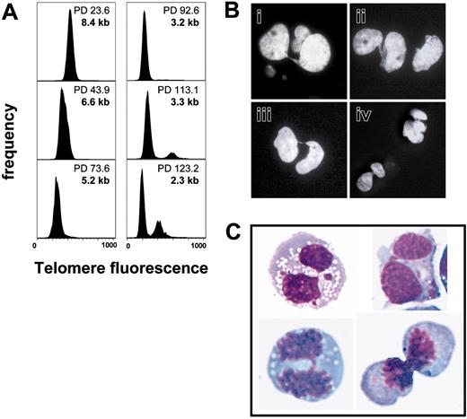 Figure 6. Telomere length analysis by automated flow-FISH of CD4+ T-cell clones transduced with hTERT. Naive CD4+ T-cell clones were transduced with hTERT and a GFP control vector. After transduction cells were sorted for GFP expression and further expanded. Telomere length was measured by automated flow-FISH. (A) Telomere fluorescence histograms at different PDs. Once the average telomere length reached approximately 3.3 kilobase (kb), a population of cells with double the telomere signal was observed. Interestingly, this population also increased in size on further culture. (B) Cell-cycle analysis also revealed an increasing fraction of cells with 4N DNA with further increase of PDs. The cells were sorted and cytospins were prepared. DNA was stained with DAPI and analyzed with a Zeiss Axioplan II fluorescence microscope. Chromatin bridges between nuclei were observed, suggesting that cells failed to complete anaphase. (C) To analyze live cells, samples were also stained with Hoechst 33342. Cells were sorted for their DNA content, cytospins were prepared and stained with Wright-Giemsa stain. Again, binucleated cells with chromatin bridges between nuclei were observed.