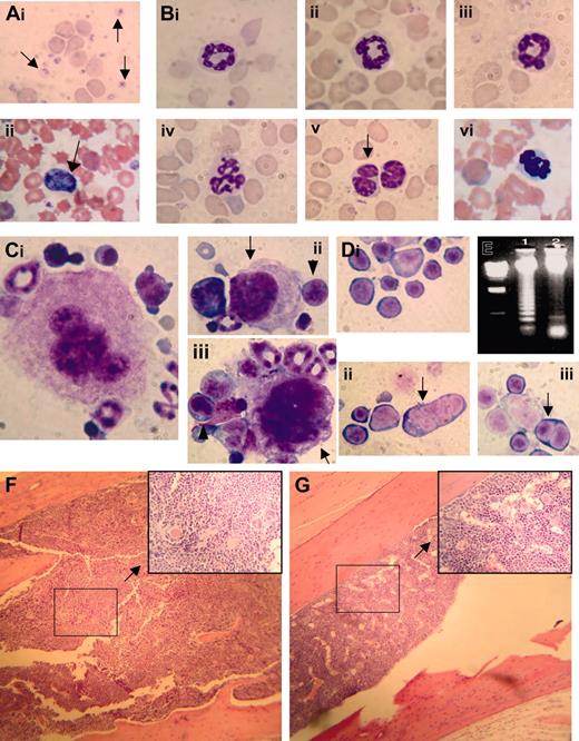 Figure 2. Myelodysplastic syndrome in NHD13 transgenic mice. (Ai) MGG-stained peripheral blood smear from control nontransgenic mouse no. 1094; normal platelets are indicated with an arrow. (ii) MGG-stained peripheral blood from mouse no. 1145 showing a giant platelet (arrow), polychromasia, and poikilocytosis. (B) High-power view of normal (i-ii, mouse no. 1093; iii, mouse no. 1094) and transgenic (iv, mouse no. 1101; v, mouse no. 1103; vi, mouse no. 1145) neutrophils stained with MGG; note hypersegmented neutrophils in iv and vi, and a pseudo-Pelger-Huet anomaly in v. (Ci) A normal megakaryocyte in bone marrow from nontransgenic control mouse (no. 1093). (ii-iii) Dysplastic megakaryocytes (arrows) from NHD13 transgenic mouse (no. 1101) showing hypolobulated nuclei and increased nuclear-cytoplasmic ratio. Erythroblasts with clefted nuclei are also seen, indicated with arrowheads. (Di) Normal erythroid precursors from a control, nontransgenic mouse (no. 1094). (ii-iii) Dysplastic, multinucleated erythroblasts (indicated with arrows) from NHD13 mice (nos. 1101 and 1145). (E) Agarose gel electrophoresis of genomic DNA isolated from transgenic (mouse no. 1103, lane 1) or nontransgenic (mouse no. 1093, lane 2) mouse bone marrow. Size standard (far left lane) is HindIII-digested λ-phage DNA. (F-G) Low-power and (inset) high-power view of H&E-stained bone marrow from NHD13 transgenic (F, mouse no. 1103) and nontransgenic control (G, mouse no. 1094).