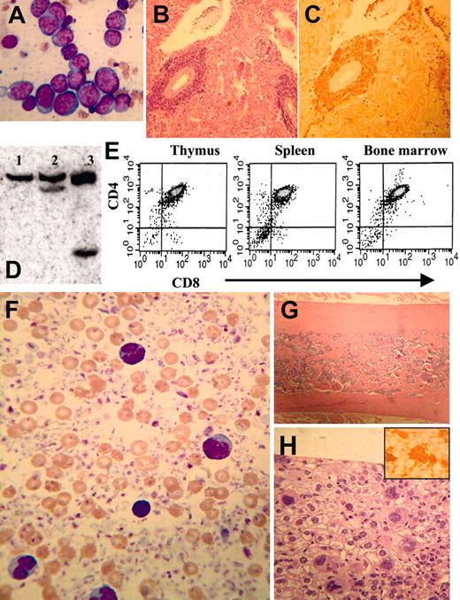 Figure 6. Pre-T (mice nos. 1149 and 1901) or megakaryocytic (mouse no. 1017) leukemia in NHD13 transgenic mice. (A) Bone marrow from mouse no. 1901 infiltrated with lymphoblasts characterized by high nuclear-cytoplasmic ratio, variably condensed nuclear chromatin, and prominent nucleoli, stained with MGG. (B-C) Perivascular infiltration of kidney from mouse no. 1901 with lymphoblasts, stained with H&E (B) or anti-CD3 (C). (D) Genomic DNA from control (lane 1) or pre-T LBL (mice nos. 1149 and 1901, lanes 2-3) mice digested with SstI and hybridized to a T-cell receptor β (TCRβ) probe. Clonal rearrangements are indicated with arrows. (E) Cells from mouse no. 1901 with pre-T LBL (thymus, spleen, and bone marrow) were stained with CD4 and CD8 and analyzed by fluorescence activated cell sorting (FACS). (F) Peripheral blood (from mouse no. 1017) smear showing dramatically increased platelet count, giant platelets, and megakaryoblasts, stained with MGG. (G) Osteosclerotic bone marrow (from mouse no. 1017) stained with H&E. (H) Liver infiltrated with megakaryocytes and megakaryoblasts, stained with H&E (inset, × 400) or anti-CD41.