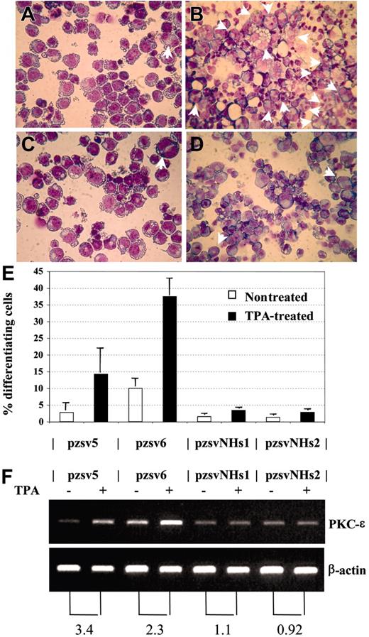 Figure 7. NHD13 inhibits megakaryocytic differentiation. (A-B) Control transfectant pzsv5, untreated (A) or treated (B) with TPA. Multinucleated cells are indicated with arrows. (C-D) Stable transfectant that expresses NHD13 (pzsvNHs1), either untreated (C) or treated (D) with TPA. (E) Percentage of differentiating cells (mean and SD of 3 independent experiments). Pzsv5 and pzsv6 are control transfectants; pzsvNHs1 and pzsvNHs2 are stable NHD13 transfectants. (F) RT-PCR for PKC-ϵ and β-actin. (Top) PKC-ϵ, (bottom) β-actin. The numbers below the picture indicate the fold increase of PKC-ϵ expression normalized to β-actin expression.