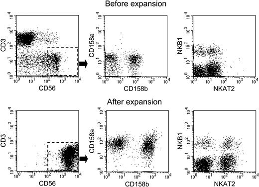 Figure 2. Immunophenotypic features of NK cells before and after expansion with K562-mb15-41BBL cells. Expression of CD3 and CD56, as well as expression of the KIRs CD158a (2DL1), CD158b (2DL2), NKB1 (3DL1), and NKAT2 (2DL3) on CD56+CD3- cells were examined in peripheral blood mononuclear cells from a healthy donor before (top row) and after (bottom row) 3 weeks of coculture with K562-mb15-41BBL cells and low-dose (10 U/mL) IL-2.