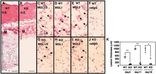 Figure 1. Lack of granulation tissue formation in MGL1-deficient mice. (A-J) Samples of inflamed skin covering the dorsal air pouch were collected on day 4 from wild-type (WT) or MGL1-deficient (KO) mice. Frozen sections were prepared and stained with hematoxylin and eosin (H.E.), with mAb LOM-14 that is reactive with both MGL1 and MGL2, with mAb LOM-8.7 that is reactive only with MGL1, and with mAb URA-1 that is reactive with MGL2, or mouse IgG. The binding of mAbs was immunohistochemically detected using biotin anti–rat κ/λ mAb plus alkaline phosphatase-streptavidin. (K) Specimens of inflamed skin covering the dorsal air pouch were collected on days 4, 11, and 18. The thickness of the granulation tissue (ordinate) was microscopically determined by measuring the hypodermis region between the muscle fiber layer and the inner surface of the air pouch. Each symbol represents the thickness of an individual wild-type mouse (open symbols) or MGL1-deficient mouse (filled symbols). Wild-type mice developed granulation tissues at the site of chronic antigenic stimulation, whereas MGL1-deficient mice did not. M represents muscle fiber layer. Bars represent 100 μm (A,B) or 10 μm (D-J). Arrows indicate positively stained cells with the mAbs. *P < .05, **P < .001.