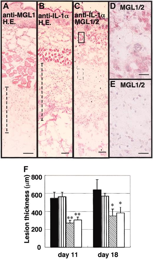 Figure 3. Effects of anti–IL-1α Ab and anti-MGL1 mAb LOM-8.7 on the formation of granulation tissue after the second antigenic challenge in the air pouch. An antigenic challenge was performed in the air pouch on days 0 and 5. Anti–IL-1α mAb, anti-MGL1 mAb LOM-8.7, or saline was subsequently injected into the air pouch on days 5, 6, and 7. Skin samples were collected on day 18 and frozen sections were prepared. (A-E) Tissue stained with hematoxylin and eosin from mAb LOM-8.7–treated mice (A), hematoxylin and eosin–stained tissue obtained from anti–IL-1α–treated mice (B), immunohistochemical staining profiles with mAb LOM-14 (anti-MGL1/2) are shown (C-E). A boxed area and a dotted boxed area in panel C are shown at higher magnifications in D and E, respectively. Very similar profiles were obtained from samples prepared on day 11 (data not shown). Scale bars represent 100 μm (A-C) and 10 μm (D-E). (F) Thickness of the granulation tissue as indicated with dotted lines in panels A and B is shown (ordinate) on days 11 and 18. ▪ represents saline-treated mice; ▥, control rat IgG instead of mAb; ▧, anti-IL-1α–treated mice; and □, anti-MGL1 mAb LOM 8.7. Mean ± standard error (SE; n = 4). Treatment with anti–IL-1α mAb significantly inhibited the formation of granulation tissues as well as the infiltration of MGL1/2-positive cells in the area far from the inner surface of the air pouch. Resident MGL1/2-positive cells in the dermis were still observed. *P < .05, **P < .01.