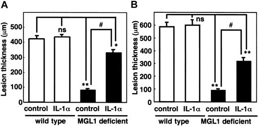 Figure 4. Effects of IL-1α on the formation of antigen-induced granulation tissue in the air pouch. (A) An antigen challenge was performed in the air pouch and recombinant murine IL-1α (5 μg/mouse) was injected into the pouch on day 0. (B) Skin samples from the air pouch were collected on day 4 (A) and day 11 (B) and frozen sections were prepared. The thickness of the granulation tissue is shown. □ indicates wild-type mice; ▪, MGL1-deficient mice. Mean plus or minus SE (n = 3). Treatment with IL-1α induced the formation of the granulation tissues at transient and chronic phases. *P < .05, **P < .001. ns indicates not significant.