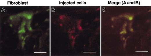 Figure 6. Examination of the cells recovered from the pouch fluid obtained from MGL1-deficient mice. An antigenic challenge was performed and cells in the pouch were collected on day 3. The CD45-negative cells were separated from the pouch fluid cell suspensions by MACS and were labeled with PHK-26. The labeled cells mixed with IL-1α (50 μg/mL) were injected into the pouch on MGL1-deficient mice on day 3. The injected cells, which were labeled with PKH26 (B), were shown also to be ER-TR7–positive and classified into fibroblasts (A). Bars represent 5 μm.