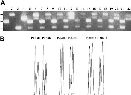 Figure 2. Biallelic expression of CCND1 alleles in D1 group of MM tumors. Paired genomic DNA and cDNA samples were used to PCR amplify 138-bp exon 4-intron 4 or, respectively, 203-bp exon 4-exon 5 DNA fragments that include an A>G polymorphism at the ultimate exon 4 nucleotide. (A) The resultant fragments were digested with HpaII, which generates 92 + 46-bp fragments or, respectively, 161 + 42-bp fragments when a G is present at the polymorphic site. Paired HpaII-digested samples were subjected to electrophoresis on a 4% Nusieve-0.5% agarose gel. Odd lanes contain genomic fragments; subsequent even lanes contain the corresponding cDNA fragment. Lanes 1-2, homozygous A allele; lanes 3-4, homozygous G allele; lanes 5-22, 9 MM tumor samples. The positions of the 203-bp, 161-bp, 138-bp, and 92-bp fragments are indicated at the left. (B) Paired sequence tracings of genomic and cDNA fragments from representative tumors that have an excess of the A allele (dotted lines), the G allele (solid lines), or equal representation of both alleles. The polymorphic A>G nucleotide and the subsequent G nucleotide are shown. Further details in “Patients, materials, and methods.”