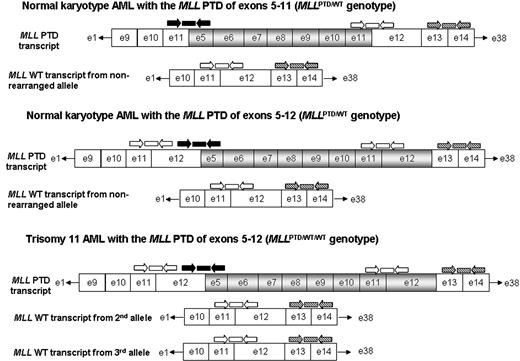 Figure 1. Schematic demonstrating the QRT-PCR strategy for detection and quantification of the MLL WT and MLL PTD transcripts in normal karyotype AML and in trisomy 11 AML. The predicted MLL PTD and WT allele-derived transcripts are shown, with the tandemly duplicated exons present in the PTD transcript denoted with gray boxes. Shown above the transcripts are sites for PCR primers (arrows) and fluorogenic probes (rectangles) designed to amplify either the exon 11 to 12 (□), exon 13 to 14 (▧), or exon 26 to 27 (not shown) junctions that are common to the MLL WT and MLL PTD transcripts. Primers and probes (▪) were used to detect the MLL PTD-specific exon 11 to 5 fusion or the exon 12 to 5 fusion found in AML cases with either the MLL PTD of exons 5 through 11 or exons 5 through 12, respectively.