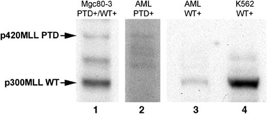 Figure 2. The p300-kDa N-terminal MLL WT protein fragment is absent in an MLL PTD+ primary AML blast sample. Immunoblot analysis was performed as described in “Materials and methods.” Lane 1, Mgc80-3 gastric carcinoma cell line with the MLL PTD gene rearrangement; lane 2, primary AML (UPN 300) with the MLLPTD/WT genotype; lane 3, primary AML (UPN 003) with MLLWT/WT genotype; and lane 4, K562 erythroleukemia cell line with the MLLWT/WT genotype. Arrows indicate the p300-kDa MLL WT posttranslational cleavage N-terminal fragment and the predicted approximate 420-kDa MLL PTD N-terminal cleavage products. Additional bands between p300 and p420 in the MLL PTD+ samples may be alternative splicing products or degradation products. Note that, to gain the signals in lane 2, the blot was exposed for a longer period.