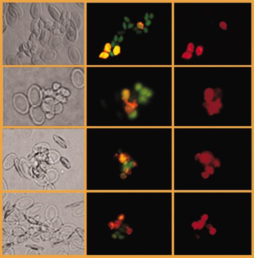 Thrombocyte clustering. See the complete figure in the article beginning on page 118.