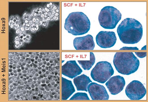 Meis1 coexpression with Hoxa9 immortalizes a distinct hematopoietic progenitor that exhibits multilineage differentiation potential and rapid monolayer proliferation. See the complete figure in the article beginning on page 254.