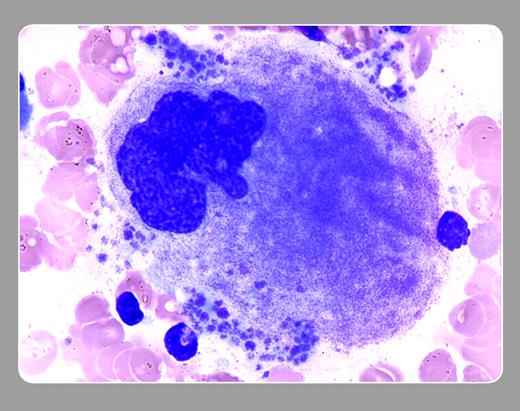 Peter Maslak, Memorial Sloan-Kettering Cancer Center