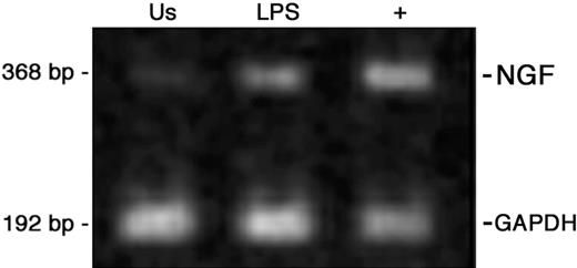 Figure 3. NGF mRNA expression in peripheral-blood monocytes. Ethidium bromide staining of RT-PCR-amplified NGF gene transcripts of human monocytes obtained from peripheral blood after 24 hours of culture and representative of 4 independent experiments. Us indicates unstimulated monocytes; LPS, LPS-treated cells; + positive control, CD34+ cord-blood cells.41