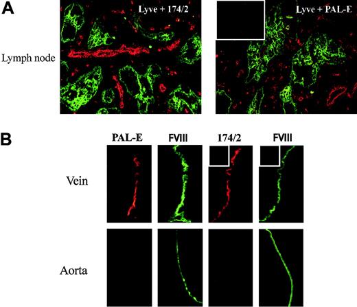 Figure 1. Staining patterns of 174/2 and PAL-E. (A) Lymph node sections were double stained with an antibody to Lyve-1 (green) recognizing lymphatics in the tissue and 174/2 (red) or PAL-E (red) as indicated in the figure. (B) Vein and aorta specimens were double stained with FITC–anti–factor VIII (FVIII, green) to identify the vascular endothelial cells and 174/2 (red) or PAL-E (red) as indicated in the figure. The insets show stainings with negative control antibodies. Original magnification ×200 (A); ×400 (D).