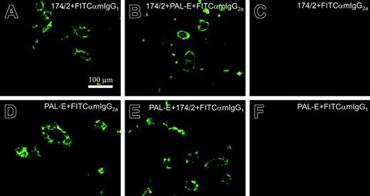 Figure 4. 174/2 and PAL-E recognize different epitopes. Competitive immunofluorescence stainings of tonsil. The incubations with different antibodies are indicated in the panels. Panels C and F are negative controls showing that the secondary antibodies used are isotype specific.