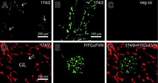 Figure 5. PV-1/FELS antigen is not expressed on typical fenestrated endothelia in kidney glomeruli or in liver sinusoids. Liver was stained with 174/2 (A-B) or neg co, 3G6, (C) followed by FITC–anti–mouse IgG1 second-stage antibody. Kidney (D-F) was double stained with 174/2 followed by PE–anti–mouse IgG1 and FITC–anti-FVIII. The arrows point to portal tracts in panel A (higher magnification in B) and the arrow points to a glomerulus (GL) in panel D.