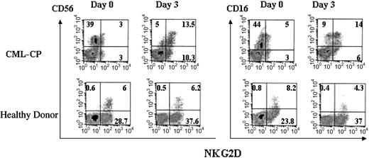 Figure 5. NKG2D expression by CD56+ cells of patients with CML and healthy donors. Cryopreserved PBLs of CML patient 10 or healthy donors were thawed and cultured in IL-2 and complete medium and analyzed directly or after 3 days (representative results from 3 patients with CML and 2 healthy donors). Numbers shown in each quadrant indicate the percentage of positive cells.