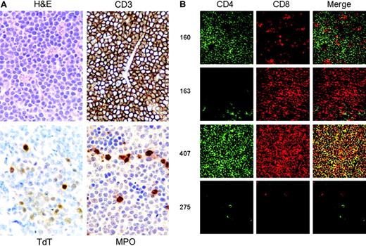 Figure 3. Immunohistochemical analyses of SL3-3–induced tumors. (A) Sections of a representative tumor of the thymus stained with either H&E or antibodies against CD3ϵ (CD3), TdT, and myeloperoxidase (MPO). (B) Immunohistochemical stainings of CD3ϵ+ tumors from different animals for double fluorescent analysis of CD4 and CD8 expression. All of the samples shown were either CD3ϵ bright (nos. 160, 163, 407 all thymus) or CD3ϵ dim (no. 275; mesentery lymph node). The genotypes of the mice with the tumors shown are Nfatc3-/- (nos. 160, 163, 407) and Nfatc2-/- (no. 275). Images were acquired with Leica TCS SP2 Confocal System equipped with a Leica DMRE microscope with an HCX PL APO 40×/1.25 NA oil CS objective lens. Images were processed with Leica Confocal Software version 2.61 (all from Leica Microsystems, Mannheim, Germany).