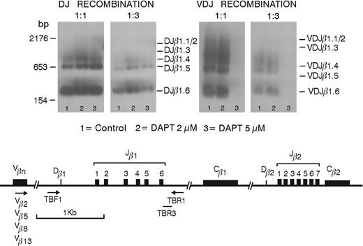 Figure 4. Inhibition of Notch signaling affects VDJβ but not DJβ rearrangements. Southern blots are shown of the products of PCR performed on cell lysates of control or DAPT-treated FTOCs, which were originally seeded with CD34+CD1- human thymic progenitor cells and were cultured for 20 days. DJβ (left) and VDJβ (right) rearrangements are shown for undiluted and 1:3 dilutions of the PCR products. Lanes 1 to 3 represent samples from untreated FTOC or FTOC in the presence of 2 or 5 μM DAPT, respectively.
