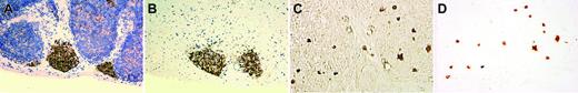 Figure 3. IL-15Rα+ immature lymphoid cells isolated from thymus of a premature infant by reverse laser capture microdissection. The figure shows a nodular pattern of IL-15Rα+ lymphoid cells in the thymus before and after rLCM (A-B, with hematoxylin counterstain), and an interstitial pattern of IL-15Rα+ lymphoid cells in the thymus before and after rLCM (C-D, phase-contrast view without hematoxylin counterstain). Note the well-preserved histopathology of IL-15Rα+ lymphoid cells isolated from a 5-μm frozen section of thymus with use of rLCM. Image acquisition was performed as described for Figure 2.