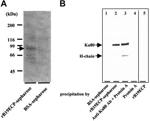 Figure 2. Determination of B19-binding protein on surface of T cell line H9. (A) Isolation of B19-binding protein from H9 surface. Surface proteins H9 of cells were biotinylated. Cell lysate from 1 × 1011 biotinylated H9 cells was mixed with rB19ECP-conjugated Sepharose or with BSA-conjugated Sepharose. Precipitated protein was isolated and reacted with streptavidin–horseradish-peroxidase conjugate on PVDF membranes, followed by the chemiluminescence detection. (B) Western blotting of protein from H9 surface with anti-Ku80 antibody. Lanes 1-4 show cell lysate precipitated with indicated protein or protein-conjugated Sepharose. Lane 5 shows the rB19ECP (1 μg) resolved by electrophoresis under denaturing conditions.