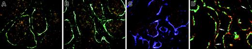 Figure 1. Patterns of GFP expression in the bones of donor mice. (A) Within trabecular bone, 3.6-green is strongly expressed on the bone surface and can extend into regions of recently formed bone. The pink cellular regions surrounded by the GFP-positive cells are bone marrow. (B) The 2.3-green is strongly expressed in bone surface cells and in the osteocytes throughout the bone. (C) The 3.6-blue expression resembles 3.6-green. (D) Nondecalcified trabecular bone of trabecular from a 3.6-green donor mouse labeled with XO 2 days before it was killed. The red label is closely associated with the majority of the GFP-positive cells although there are regions of XO labeling without overlying GFP-positive cells (arrows). (A-D) Original magnification, × 200.