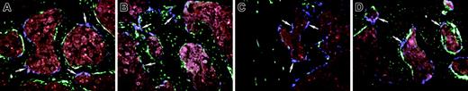 Figure 2. Engraftment of bone lining cells after transplantation with TBM from 3.6-blue donor mice. (A-B) An image of frozen decalcified bone (A, femur; B, tibia) from a 3.6-green recipient rescued with systemic TBM from a 3.6-blue donor. The 3.6-blue cells (arrows) are present on the bone surface admixed with 3.6-green cells. Note that the 3.6-blue cells do not extend into the osteocyte layer. (C-D) An image of the bone from a 2.3-green host that received an intramedullary injection of TBM from a 3.6-blue mouse. The 3.6-blue cells line the bone surface whereas the host cells express 2.3-green on the bone surface and within osteocytes. (C) Injected tibia. (D) The contralateral femur also demonstrates 3.6-blue cells, indicating engraftment by a systemic route. (A-D) Original magnification, × 200.