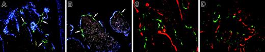 Figure 3. Engraftment of bone lining cells after transplantation with TBM from 3.6-green donor mice. (A-B) Engraftment of 3.6-green donor-derived TBM cells. The recipient was a 3.6-blue mouse. (A) Injected tibia. (B) Ipsilateral femur. Now 3.6-green cells (arrows) line the bone but do not extend into the bone matrix. (C-D) Frozen nondecalcified section of bone from a nontransgenic recipient rescued by an intramedullary injection of TBM from a 3.6-green mouse. The recipient mouse was injected with XO 2 days prior to being killed. The injected femur (C) and the contralateral tibia (D) show bone surface 3.6-green cells but no associated XO labeling. (A-D) Original magnification, × 200.