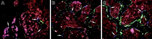 Figure 4. Temporal sequence of engraftment of donor-derived 3.6-blue bone lining cells in a 2.3-green recipient. Mice from the same TBI/rescue experiment were examined at days 7, 14, 21, 28, 56, and 78 after systemic transplantation. Shown here are representative images at day 14 (A, when 3.6-blue cells first appear, arrows), day 28 (B), and day 78 (C). Digital thresholding and counting of the number of 3.6-blue cells in each image was (A) 28, (B) 37, and (C) 48. (A-C) Original magnification, × 200.