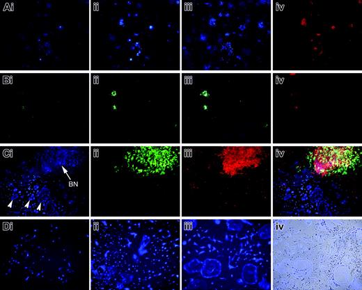 Figure 5. Fluorescent images of marrow stromal-cell culture grown in a 6-well plate. Each panel is formed from × 25 to × 2.5 original magnification images that are tiled together, and represents approximately 60% of the surface area of a cell-culture well. The same well is recorded at increasing days of culture (days 10-28) and the fluorescent spots that develop over time are produced by the strong GFP expression within the bone nodule. At day 21 the nodules that have mineralized are visualized by the XO staining that colocalized with the GFP nodules (Aiv,Biv). (A) Profile of developing bone nodules from an irradiated 3.6-blue transgenic mouse to illustrate the bone nodule-forming potential of the osteoprogenitor population in a bone marrow stromal culture. Images from days 14 (Ai), 18 (Aii), and 21 (Aiii) show nodule progression and the extent of mineralization at day 21 is shown by XO staining (Aiv). (B) Stromal-cell culture derived from a 2.3-green recipient mouse that was rescued by WBMT from a 3.6-blue donor. Although the number of host-derived 2.3-green bone nodules is diminished relative to nonirradiated controls (not shown), only host-derived nodules are observed. Images from days 14 (Bi), 18 (Bii), and 21 (Biii) show nodule progression and the extent of mineralization at day 21 is shown by XO staining (Biv). (C) Fluorescent image (original magnification, × 50) of a 2.3-green nodule as seen in the × 25 (original magnification) tiled image in panel B. The 2.3-green nodule (Cii) shows strong mineralization (Ciii). Panel Ci shows the cluster of 3.6-blue donor-derived cells (arrowheads) that happened to form adjacent to this 2.3-green nodule. It has a distinctly different morphology than the bone nodule (BN) that in this image is blue in color because the 2.3-green signal seen in panel Cii spills through the GFPcyan filter. Panel Civ shows the composite image of the 3.6-blue cell cluster and 2.3-green/XO bone nodule. (D) Fluorescent and phase-contrast image (original magnification, × 100) of 3.6-blue cells that develop in a stromal-cell culture derived from a recipient mouse rescued with TBM from a 3.6-blue donor mouse. The expanding cluster of cells does not become a multilayered nodule and does not stain with XO. Images from days 10 (Di), 21 (Dii), and 28 (Diii) show the cellular progression. The overlay (Div) with the phase-contrast image shows the 3.6-blue cells relative to the nonfluorescent cells in the field of view.