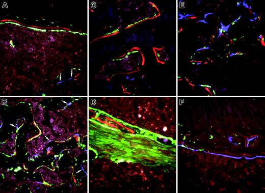 Figure 6. High-power images of bone from nontransgenic recipients of an intramedullary injection of calvarial stromal cells. (A-B) Calvarial progenitor cells from a 2.3-green donor mouse injected into a nontransgenic recipient and rescued with TMB from a 3.6-blue donor. Selected images (original magnification, × 200) show engraftment of diaphyseal bone (A) and formation of new trabecular bone (B) and illustrate the association of XO label with 2.3-green cells. Because the 2.3-green marker gene remains active in osteocytes, marked donor cells become incorporated into the host bone and within the newly formed trabecular bone. In contrast, the 3.6-blue cells (arrows) remain on the bone surface and are not associated with the XO label. These images are obtained from the scan shown in Figure 7A. (C-D) Calvarial progenitor cell from a 3.6-green donor mouse injected into a nontransgenic recipient that was rescued TBM from a 3.6-blue donor. Selected images (original magnification, × 200) show engraftment of pre-existing bone (C) and formation of new trabecular bone (D) that appears to be derived from the fibroblastic tract. Both structures exhibit donor-derived osteoblasts (strong GFP signal) in association with the XO label. The fibroblastic-shaped cells along the injection tract are not associated with bone mineralization and run between regions that have produced trabecular bone. These images are obtained from the scan shown in Figure 7B. (E-F) Nondecalcified sections of a femur showing engraftment of 3.6-blue donor-derived calvarial cells after injection into a 3.6-green host that was rescued with nontransgenic TBM. (E) Trabecular region. (F) Cortical region. In both images there is commingling of 3.6-blue donor and 3.6-green host cells on the bone surface that is associated with the XO label.