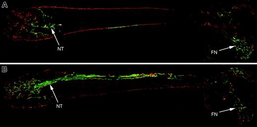 Figure 7. Histology from a nontransgenic recipient mouse that received a transplant via intramedullary injection of TBM from a 3.6-blue donor and expanded calvarial progenitor cells from a 3.6-green or 2.3-green donor. The recipient mice were injected with XO 2 days prior to being killed. (A) Full-length section of bone transplanted with calvarial progenitor cells from a 2.3-green donor mouse and TBM from a 3.6-blue donor. The needle tract (NT) is less obvious with the 2.3-green marker gene because it only visualizes mature osteoblasts. Distal engraftment is apparent in the femoral neck (FN) region. (B) Full-length section of bone transplanted with calvarial progenitor cells from a 3.6-green donor mouse and TBM from a 3.6-blue donor. The needle tract (NT) is composed of newly formed trabeculae and a core of fibroblastic-shaped progenitor cells. Bone lining cells of donor origin are present at sites distal to the injected cells such as the femoral neck region.