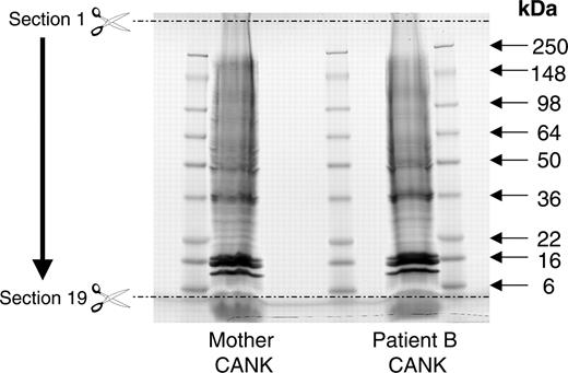 Figure 1. One-dimensional gel separation of CANK cell membrane–enriched fractions. One hundred micrograms of CANK cell membrane–enriched fractions obtained from patient B and his mother were separated on 4% to 20% Tris-glycine gel. Nineteen equally spaced sections between 250 kDa and 6 kDa were excised from each fraction and were subsequently used for proteomic analysis.