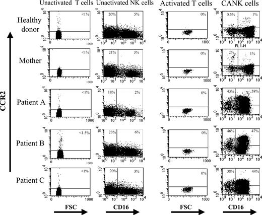 Figure 4. Specific augmented expression of CCR2 on CANK cells derived from patients with TAP-2 deficiency. Surface expression levels of CCR2 on unactivated, CANK, and activated T cells derived from multiple blood samples obtained from healthy donors (representative staining for 1 of 23 healthy donors), the mother of patients A, B, and C with TAP-2 deficiency, and the patients themselves. Indicated values represent the percentages of cells positive for CCR2 of that total lymphocyte subset. Results are from 1 representative experiment of 3 experiments performed on lymphocytes and cell lines generated on 3 independent occasions from each donor.