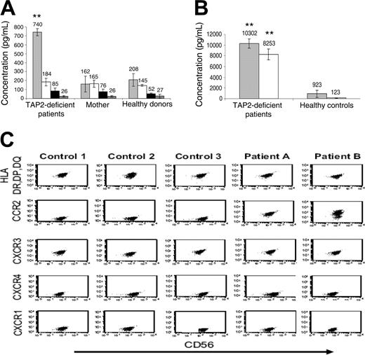 Figure 7. Analysis of NK cells and cytokines in serum and bronchioalveolar lavage samples from patients with TAP-2 deficiency. (A) Serum samples obtained from patients A, B, and C, their mother, and 9 healthy donors were analyzed by ELISA assays for the detection of MCP-1 (▦), SDF1 (□), IP10 (▪), and secondary lymphoid tissue chemokine (SLC; ▩) chemokines. Results are of 1 representative experiment of 3 experiments performed on serum samples obtained on 3 independent occasions from each donor. (B) MCP-1 (▦) and IL-2 (□) levels in BAL samples obtained from patients A and B were compared with those in BAL samples obtained from 5 controls without underlying pulmonary disease. (C) Purified NK cells from BAL samples obtained from patients A and B were compared with those of BAL samples obtained from 3 immunosuppressed patients with sustained lung infection and inflammation and were analyzed for the expression of HLA-DR, DP, DQ, CCR2, CXCR3, CXCR4, and CXCR1 receptors. ** P < .001 by Student t test. Error bars indicate SD.