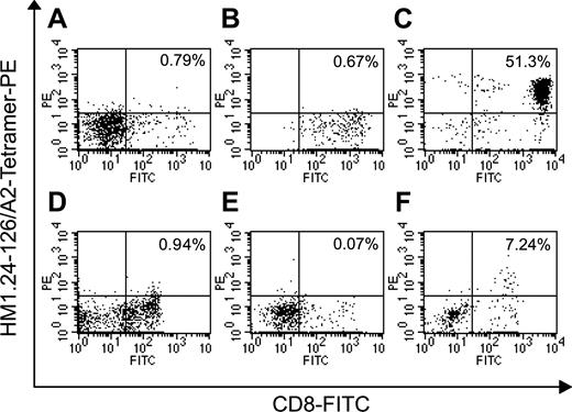 Figure 3. Tetramer analysis of HM1.24 peptide–specific T cells. CD8+ T cells from normal PBMCs (HLA-A2+, A24-) or PBSC harvests of patient no. 3 (HLA-A2+, A24-) were stimulated with autologous DCs pulsed with HM1.24-126 or MAGE-3-195 peptides 3 times. Normal PBMCs (A), MAGE-3–stimulated CD8+ cells (B), HM1.24-126–stimulated CD8+ cells (C), PBSC harvests (D), MAGE-3–stimulated PBSC harvests (E), and HM1.24-126–stimulated PBSC harvests (F) were stained with FITC-labeled anti-CD8 MoAb and PE-labeled HM1.24-126/A2 tetramer and were analyzed by 2-color flow cytometry. The numbers represent the percentage of CD8+/tetramer+ cells. Negative control staining showed less than 0.1% of CD8+/tetramer+ cells in each experiment.