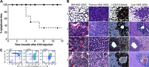 Figure 1. Runx1lacZ/lacZ chimeras are more susceptible to developing T-lymphoblastic lymphoma than wild-type chimeras. (A) Kaplan-Meier survival curves (lymphoma-free) are shown for untreated Runx1lacZ/lacZ (n = 6) and Runx1lacZ/lacZ (n = 6) and wild-type (n = 6) chimeras treated with 100 mg/kg ENU. • indicates untreated Runx1lacZ/lacZ chimeras; ▪, wild-type ES-cell chimeras treated with ENU; ▴, Runx1lacZ/lacZ chimeras treated with ENU. (B) Hematoxylin and eosin (H&E) staining of thymus, bone marrow (BM), and liver from LZD nos. 2 through 5. Immunohistochemistry using an anti-CD3 antibody demonstrates that the malignant cells in the livers of these animals stained positively for CD3. (C) Flow cytometry of thymocytes from LZD no. 2 and LZD no. 4 using antibodies against CD4 and CD8 demonstrates that the majority of cells have an abnormal CD4+/CD8+ phenotype. WT indicates wild type. Numbers in each quadrant indicate the percentage of total thymocytes in that quadrant.
