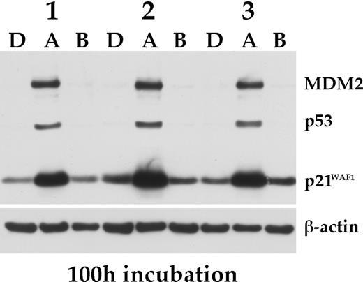 Figure 4. Effect of nutlin-3a on BMSCs. Primary BMSCs from 3 different donors were exposed for 100 hours to nutlin-3a (A), nutlin-3b (B), each at 10 μM, or DMSO (D), and the status of p53, MDM2 and p21WAF1 determined by Western analysis.