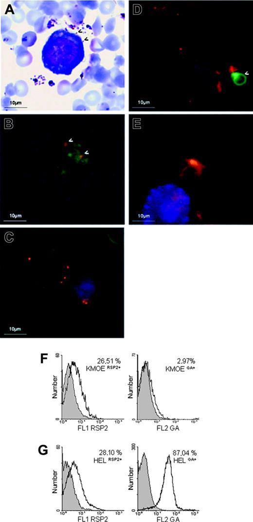 Figure 2. RSP2 on the surfaces of erythroid precursor cells. (A) Cocultured. erythroblasts/parasites stained with Giemsa at merozoite reinvasion, showing interaction with the surface of a HEL 92.1.7 cell. (arrows) Merozoites interacting with the erythroblast surface. (B) Double labeling (IFA) of an FCR3CSA/HEL 92.1.7 coculture at the time of reinvasion, using an anti-MSPp19 mAb (red) and B4 (green). (arrows) RSP2 transferred to the sites of interaction between merozoites and the cell. (C-D) L-IFA with the B4 (red) and anti-GA mAbs (green) of HEL 92.1.7 erythroblasts. GA+ (C) and KMOE-2 GA- (D) cells isolated from cocultures with FCR3 parasites. Arrows indicate GA+ erythrocytes. Nuclei are labeled with DAPI (blue). Independently acquired images were overlaid. (E) L-IFA with anti-RSP2 mAb B4 (red), anti–GA mAb (green), and anti-CD45 mAb (blue) of ex vivo myeloid cells. Flow cytometry quantification of RSP2 on HEL 92.1.7 and KMOE-2 erythroblasts, normalized according to GA expression (F-G). The percentage of RSP2-positive cells was determined by subtracting cells positive for the isotypic controls. We found that 26.51% of KMOE-2 GA-erythroblasts cocultured with FCR3CSA were RSP2+ (A) compared with 28.10% of HEL 92.1.7 GA+ erythroblasts (B).