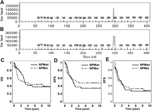 Figure 1. Detection of NPM exon 12 mutations and patient outcome. PCR fragment analysis of NPM exon 12 amplification showed (A) one peak in patients with NPMwt and (B) an additional peak at 301 bp in mutated patients, corresponding to a 4 bp insertion. (C) Overall survival, (D) relapse-free survival, and (E) event-free survival are shown for NPMwt and NPMm patients.