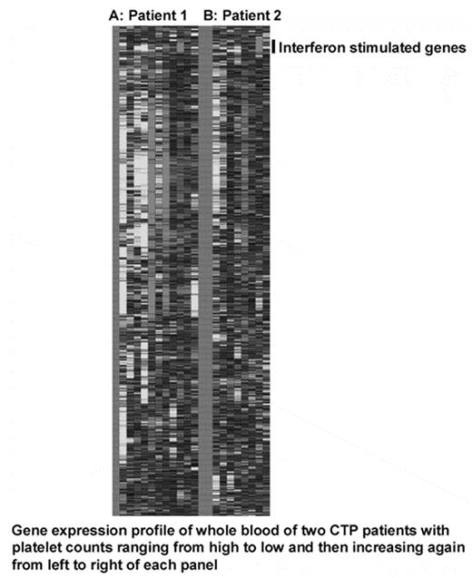 Gene expression profile of whole blood of two CTP patients with platelet counts ranging from high to low and then increasing again from left to right of each panel
