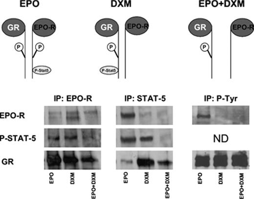 Figure 1:. Summary of the IP with EPO-R, STAT-5 and P-Tyr specific antibody processed by WB for EPO-R, P-STAT-5 and GR, as indicated. A model summarizing the results is described on the top.