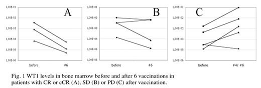 Fig. 1. WT1 levels in bone marrow before and after 6 vaccinations in patients with CR or cCR (A), SD (B) or PD (C) after vaccination.