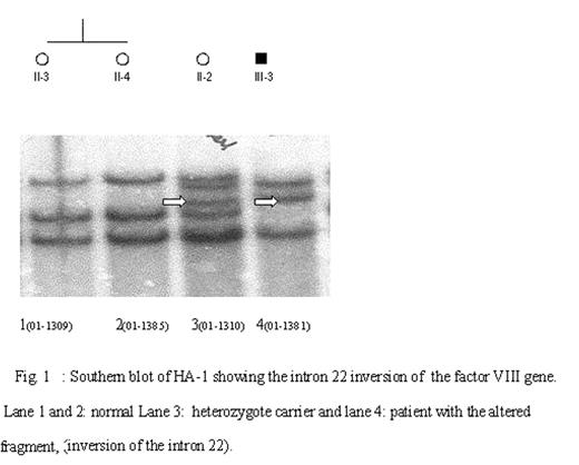 Fig. 1. Southern blot of HA-I showing the intron 22 inversion of the factor VIII gene. Lane 1 and 2 normal Lane 3: heterozygote carrier and lane 4: patient with the altered fragment, (inversion of the intron 22).