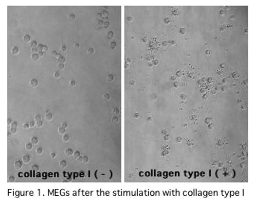 Figure 1. MEGs after the stimulation with collagen type I
