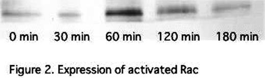 Figure 2. Expression of activated Rac