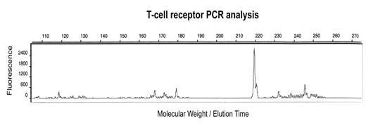 T-Cell receptor PCR analysis