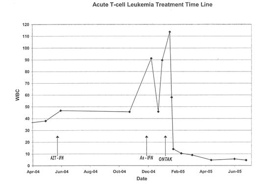 Acute T-cell Leukemia Treatment Time Line