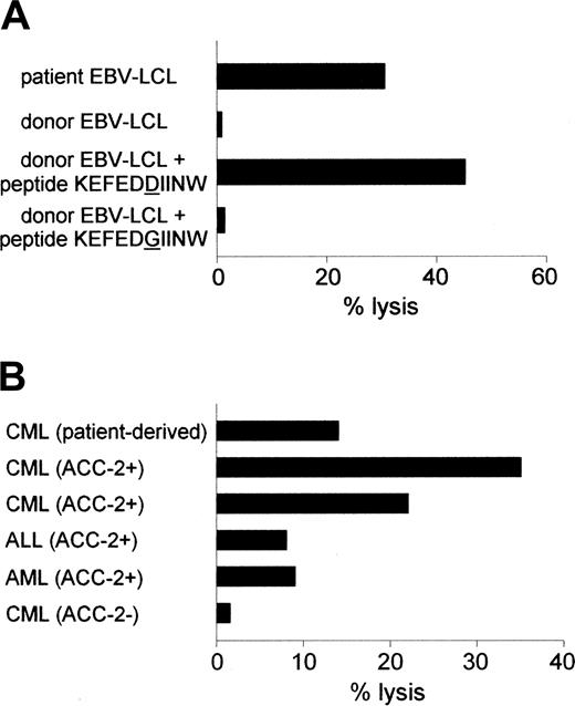 Figure 1. Reactivity of the ACC-2–specific CTL clone against hematopoietic cells. (A) Cytolytic activity of CTL clone 65 against patient-derived EBV-LCLs and donor-derived EBV-LCLs loaded with ACC-2 peptide KEFEDDIINW but not against donor-derived EBV-LCLs loaded with ACC-2 control peptide KEFEDGIINW. (B) Lysis of patient-derived CML cells and leukemic cells from unrelated HLA-B44+, mHag ACC-2+ individuals but not of leukemic cells from an unrelated HLA-B44+, mHag ACC-2- individual by CTL clone 65. Cytotoxicity was measured at an E/T ratio of 10:1.