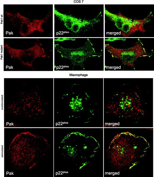 Figure 7. Active Pak colocalizes with p22phox in the plasma membrane. Cos cells expressing p22phox were transfected with wild-type Myc-Pak1 or Myc-Pak1 F107, E423 for 24 hours and prepared for confocal microscopy. Human monocytes were differentiated into macrophages in vitro and either left untreated or stimulated with 1 μM fMLF for 3 minutes. Localization of proteins in all panels was assessed by confocal microscopy after fixation and costaining for Pak and p22phox. A representative image of 2 independent experiments is shown.